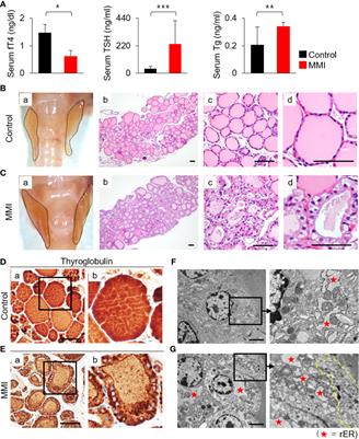 Primary Cilia Mediate TSH-Regulated Thyroglobulin Endocytic Pathways